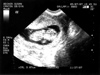 First Ultrasound